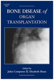 The bone disease of organ transplantation