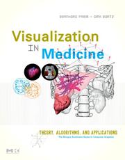 Visualisation in medicine : theory, algorithms, and applications