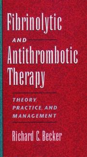 Fibrinolytic and antithrombotic therapy : theory, practice, and management