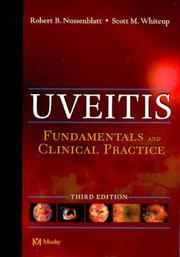 Uveitis : fundamentals and clinical practice