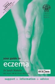 Your guide to eczema