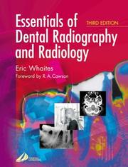 Essentials of dental radiography and radiology