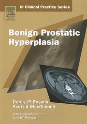 Benign prostatic hyperplasia