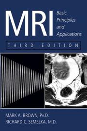 MRI : basic principles and applications