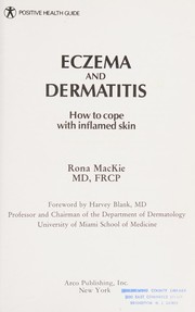 Eczema and dermatitis by Rona M. MacKie