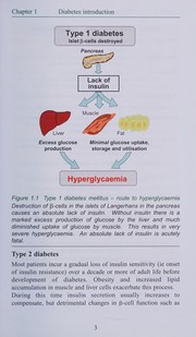 Cover of: Diabetes therapies: treating hyperglycaemia