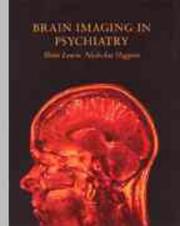 Brain imaging in psychiatry