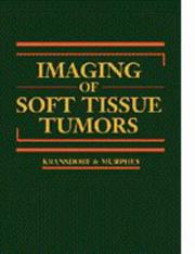 Imaging of soft tissue tumors