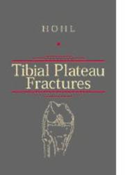 Tibial plateau fractures by H. Mason Hohl