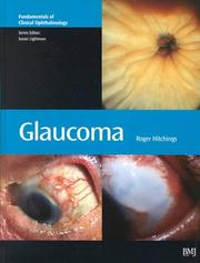 Glaucoma