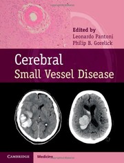 Cover of: Cerebral Small Vessel Disease