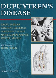 Cover of: Dupuytren's disease