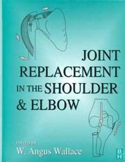 Joint replacement in the shoulder and elbow