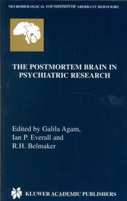 The postmortem brain in psychiatric research