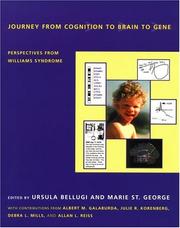 Journey from cognition to brain to gene : perspectives from Williams syndrome