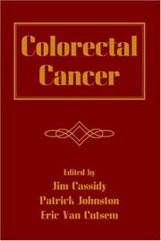 Colorectal cancer