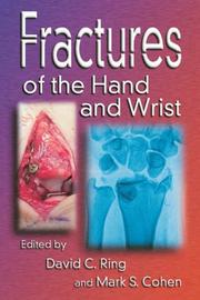 Fractures of the hand and wrist