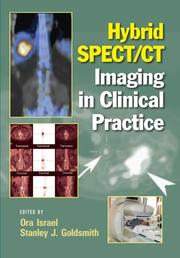 Hybrid SPECT/CT imaging in clinical practice