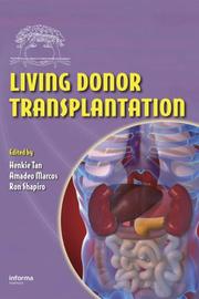 Living donor transplantation