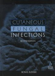 Cutaneous fungal infections