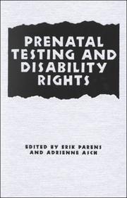 Prenatal testing and disability rights