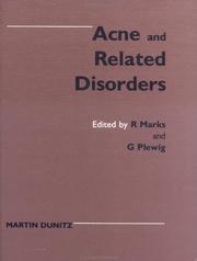 Acne and related disorders