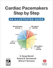 Cardiac pacemakers step by step : an illustrated guide