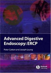 Advanced digestive endoscopy : ERCP