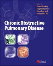 Chronic obstructive pulmonary disease