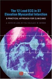 Cover of: The 12 Lead ECG in ST Elevation Myocardial Infarction by Antonio Bayés de Luna, Miguel Fiol-Sala, Elliot M. Antman, Antonio BayéS De Luna