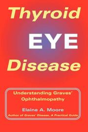 Cover of: Thyroid Eye Disease: Understanding Graves\' Ophthalmopathy