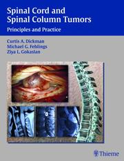 Cover of: Spinal Cord And Spinal Column Tumors |