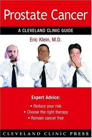 Cover of: Prostate Cancer (A Cleveland Clinic Guide) (Cleveland Clinic Guides)