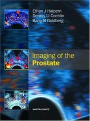 Imaging of the prostate