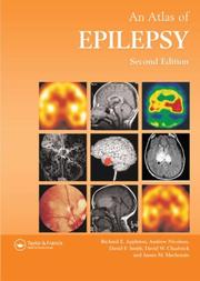 Cover of: Atlas of Epilepsy, Second Edition by Richard Appleton, Andrew Nicolson, David Smith April 29, 2008, David Chadwick, James Mackenzie