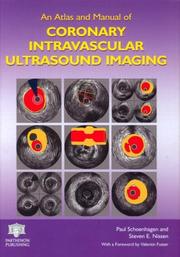 Cover of: An Atlas and Manual of Coronary Intravascular Ultrasound Imaging