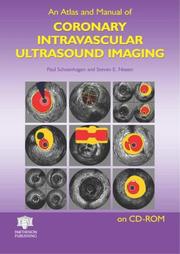Cover of: An Atlas and Manual of Coronary Intravascular Ultrasound Imaging on CD-ROM