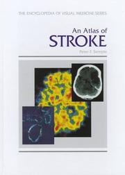 An atlas of stroke by Peter F. Semple, R.L. Sacco