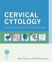 Cervical cytology : conventional and liquid-based