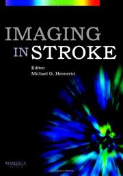 Imaging in stroke