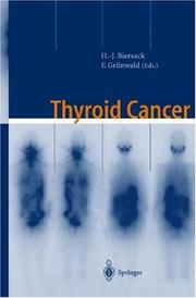 Thyroid cancer