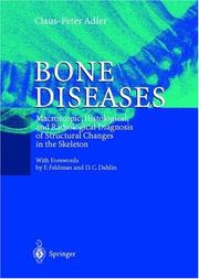 Bone diseases : macroscopic, histological, and radiological diagnosis of structural changes in the skeleton