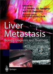 Liver metastases : biology, diagnosis, and treatment