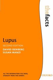 Cover of: Lupus (The Facts)