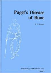 Cover of: Paget's Disease of the Bone: Assessment and Management