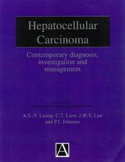Hepatocellular carcinoma : diagnosis, investigation and management