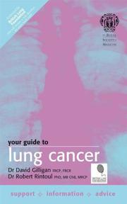 Your guide to lung cancer