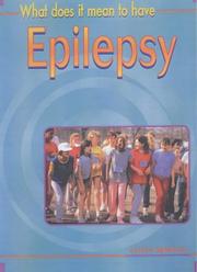 What does it mean to have epilepsy?
