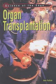 Organ transplantation