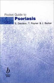 Pocket guide to psoriasis